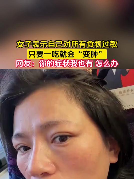女子表示自己对所有食物过敏,只要一吃就会“变肿”,网友:你的症状我也有 怎么办