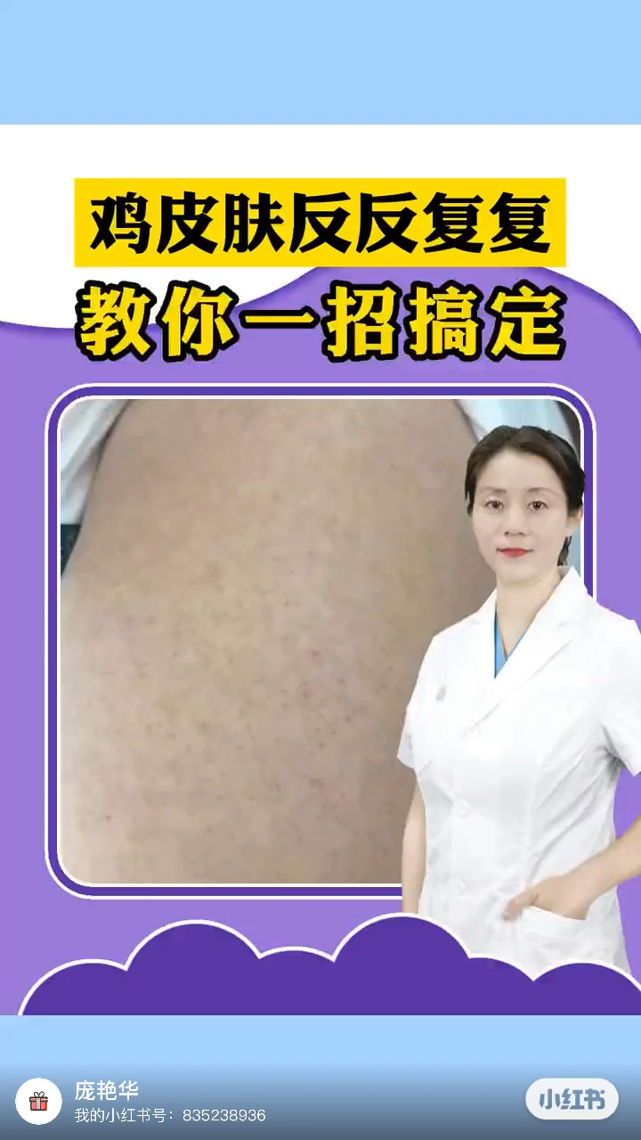 鸡皮肤反反复复教你一招搞定