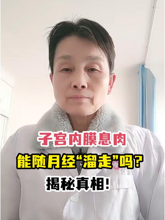 子宫内膜息肉能随月经“溜走”吗?揭秘真相!