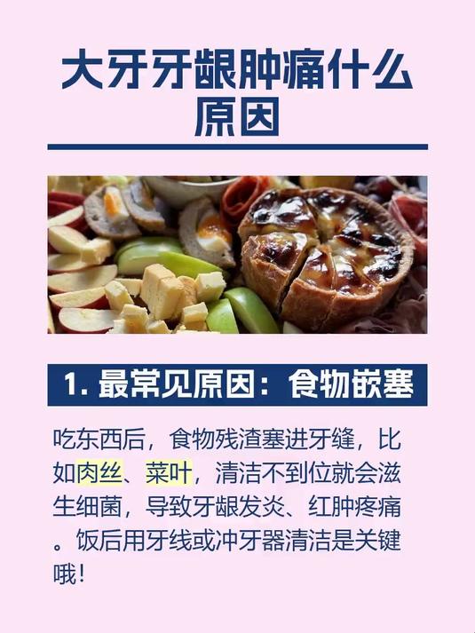 #马上健康过大年#大牙牙龈肿痛什么原因
