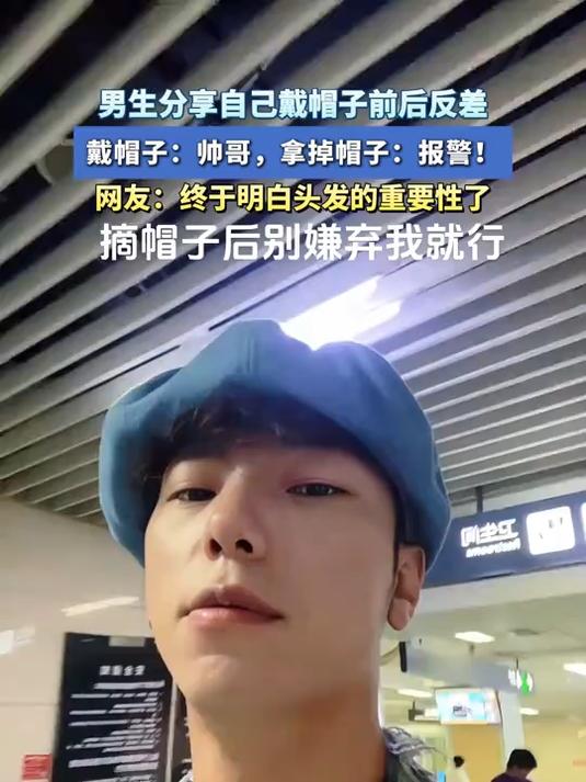 男生分享自己戴帽子前后反差,网友:直观感受到了头发的重要性