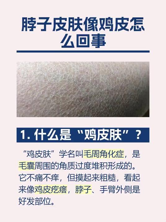 脖子皮肤像鸡皮怎么回事