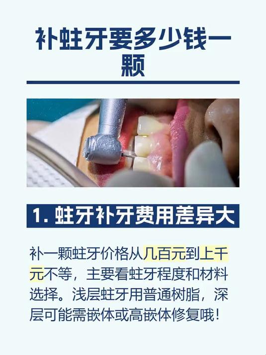 补蛀牙要多少钱一颗