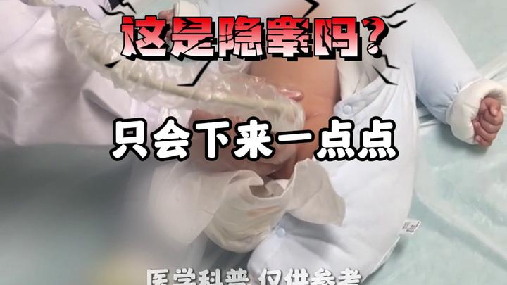 宝宝睡觉蛋蛋也不下来