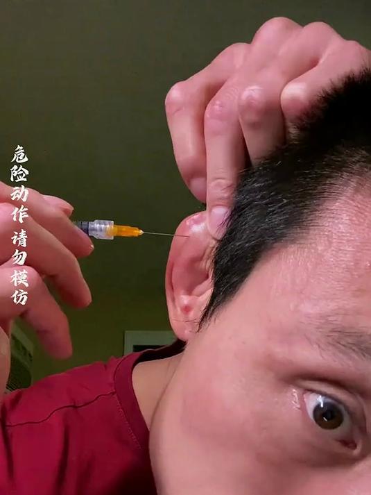 千万不要惹怒这种耳朵肿胀的人,因为他的力量强大到你无法想象!