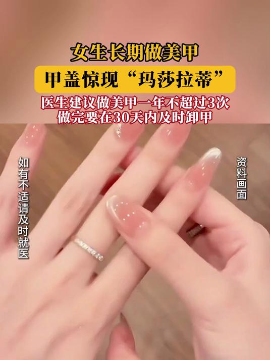 女生长期做美甲，甲盖惊现“玛莎拉蒂”！