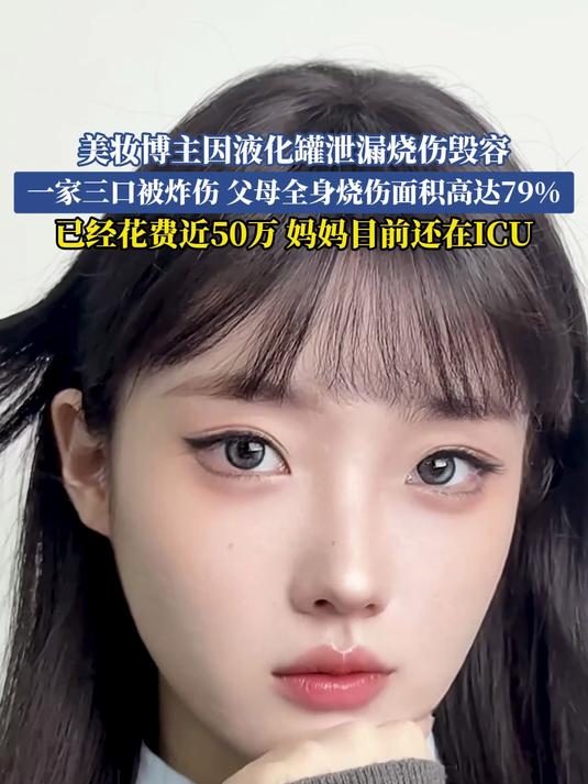 美妆博主因液化罐泄漏烧伤毁容,一家三口被炸伤父母全身烧伤