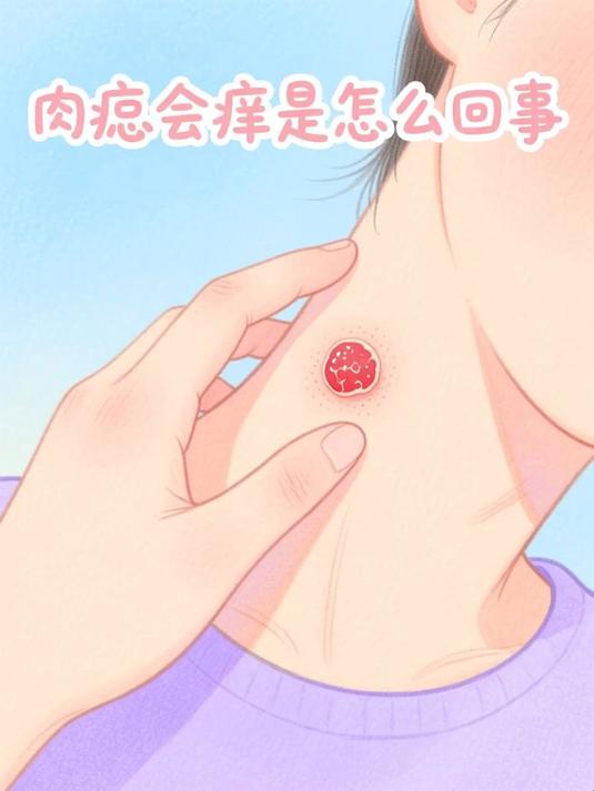 肉痣会痒是怎么回事 #健康扬帆季#