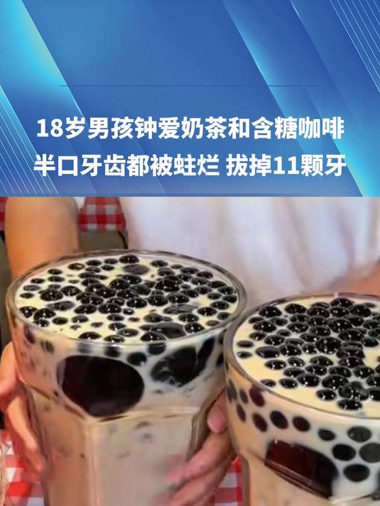 18岁男孩钟爱奶茶和含糖咖啡 半口牙齿都被蛀烂 拔掉11颗牙