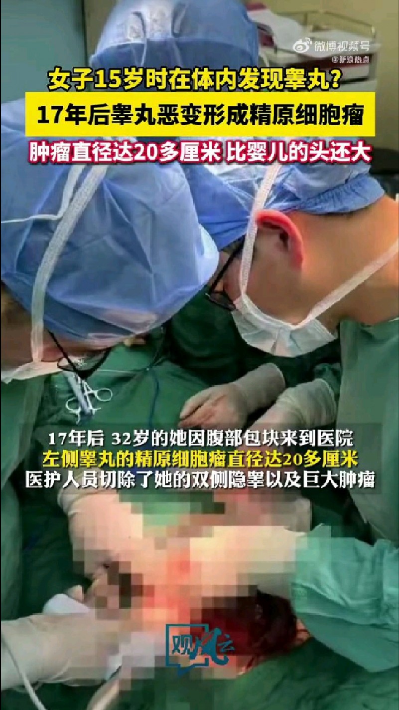 【#32岁女子腹中竟发现男性睾丸#17年后睾丸长出肿瘤比婴儿头大#】