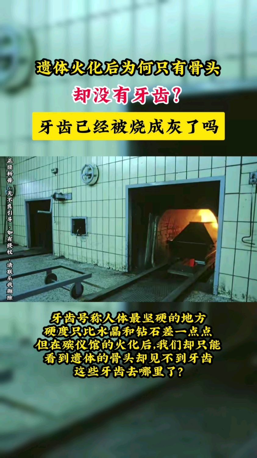 遗体火化后,为何只有骨头却没有牙齿?牙齿已经被烧成灰了吗?
