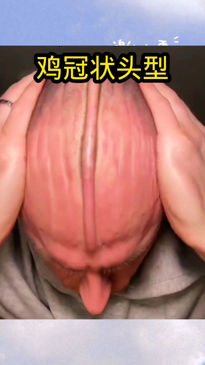 鸡冠状头型,国外男子真了不起!