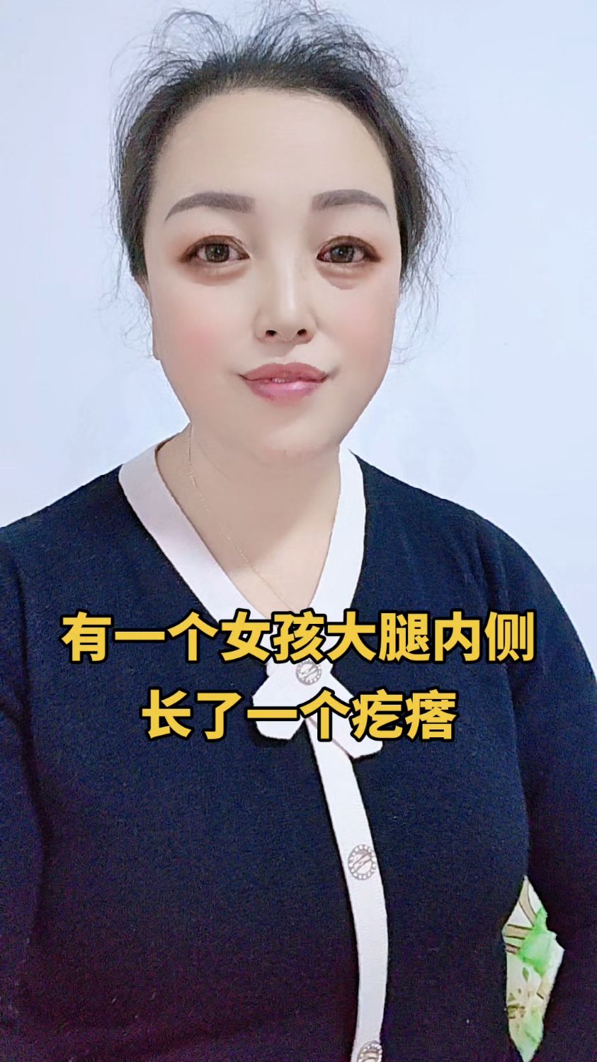 有一个女孩大腿内侧长了一个疙瘩