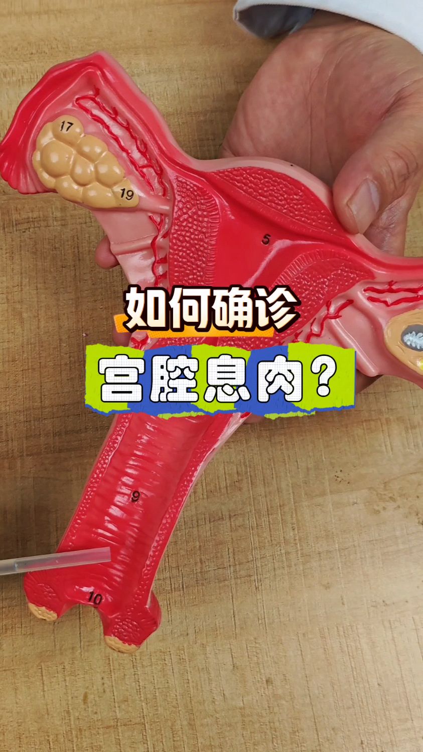 如何确诊宫腔息肉!