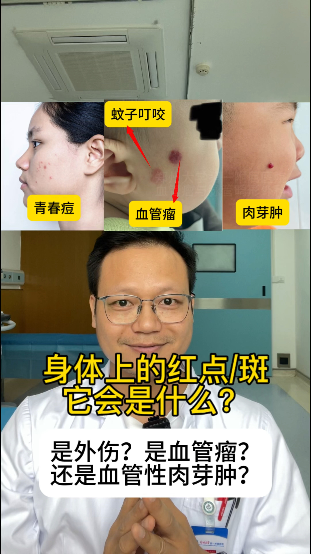 青春痘?血管瘤?还是肉芽肿?