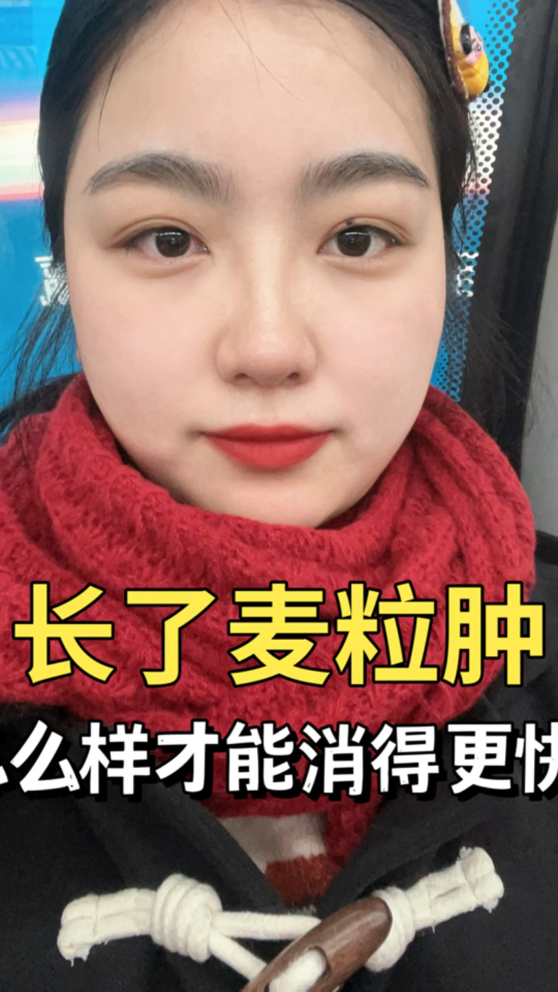 长了麦粒肿,怎么样才能消得更快?