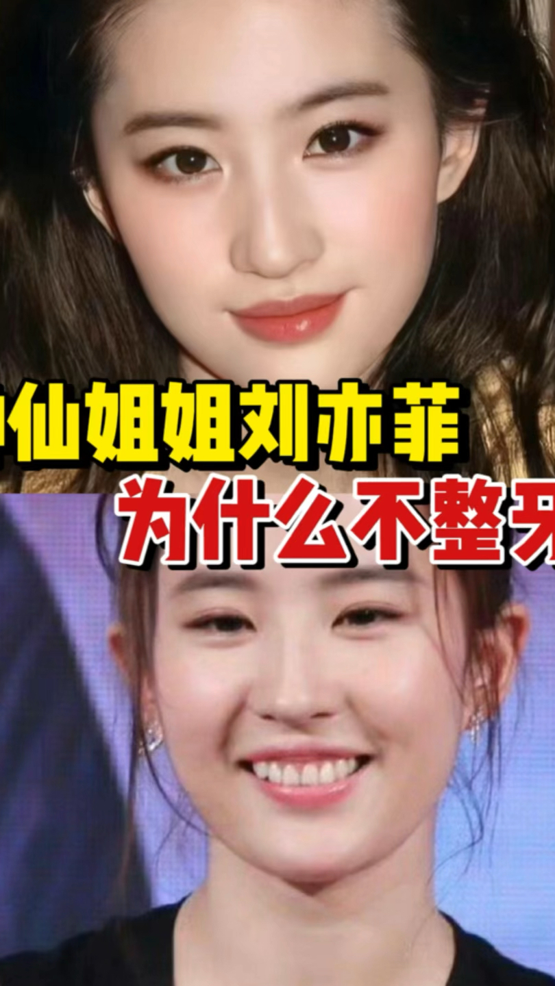 神仙姐姐刘亦菲,为什么不整牙?