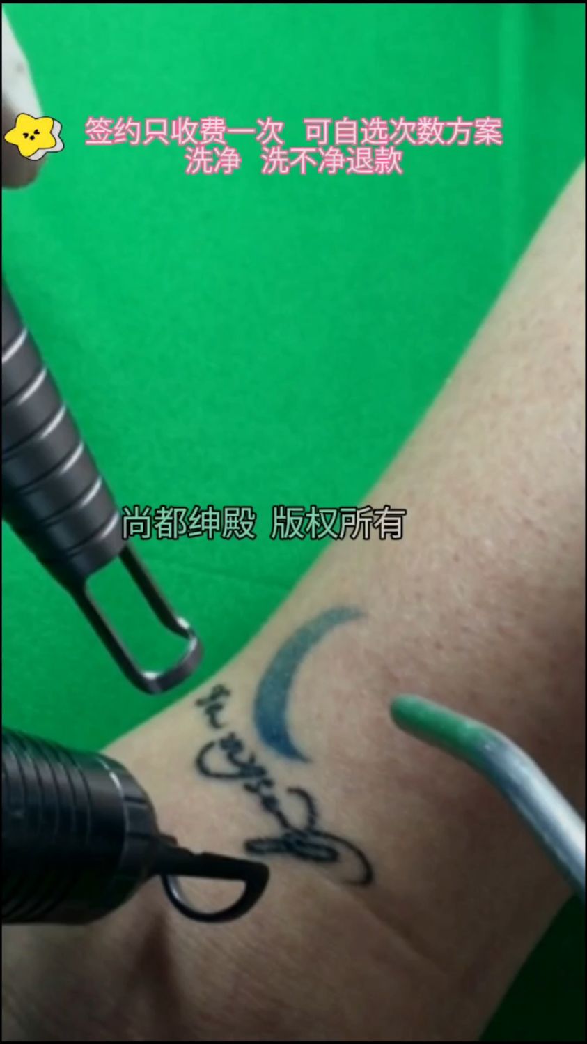 月亮纹身真的可以洗掉吗 答案是肯定的