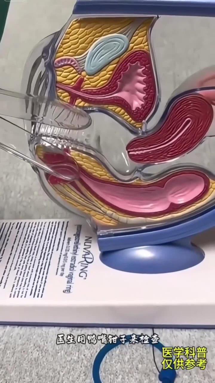 视频中展示医生如何用鸭嘴钳子检查患者身体 模拟训练