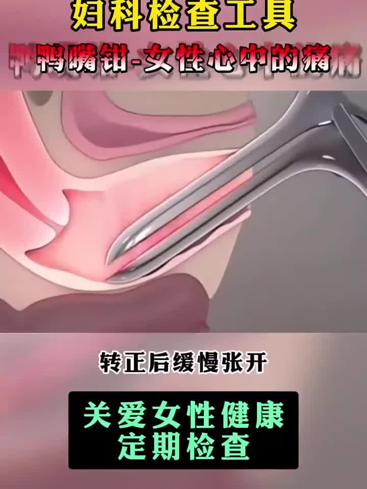 妇科检查工具