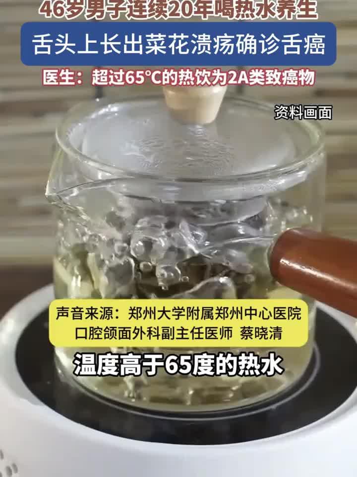 46岁男子20年热水养生反致舌癌,舌面惊现菜花状溃疡