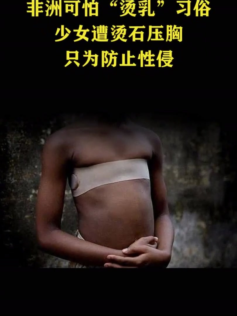 非洲可怕的烫乳习俗!在非洲西部,喀麦隆的母亲们,为防止女儿
