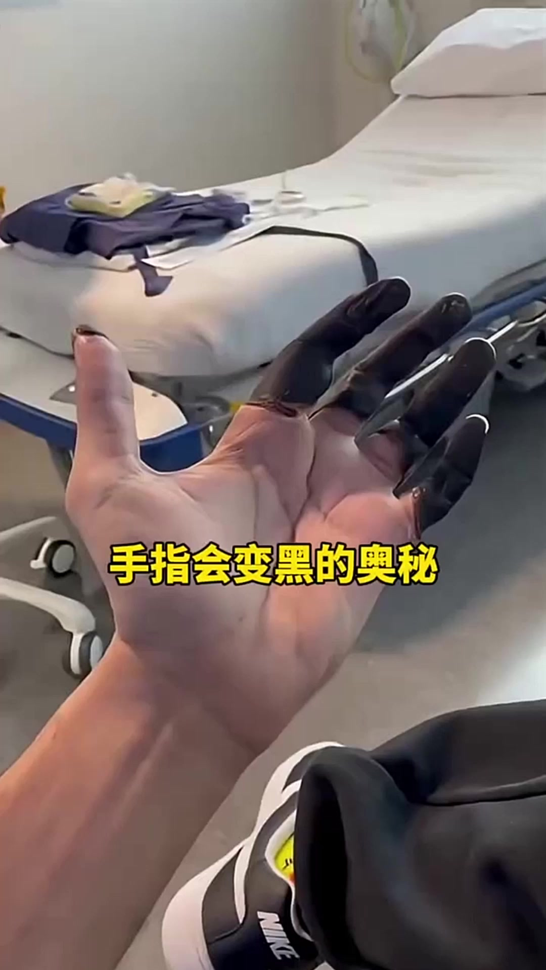 手指会变黑的奥秘