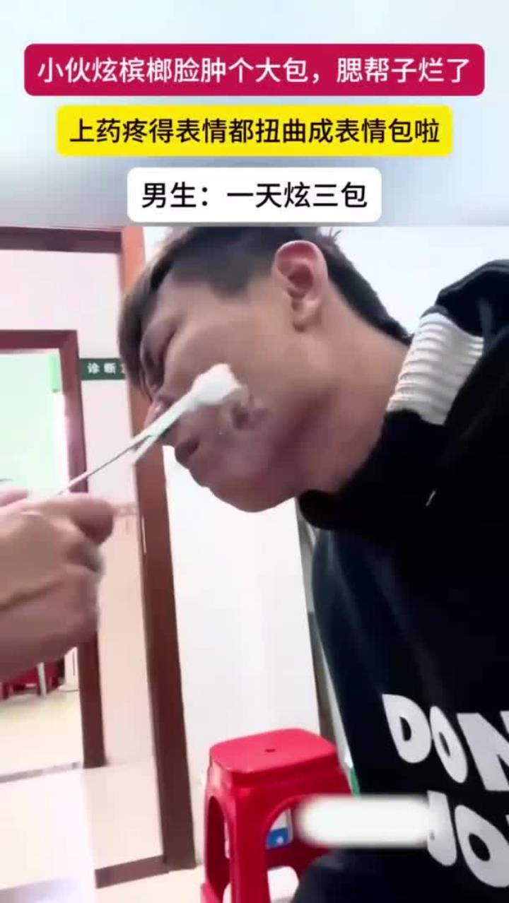 小伙吃槟榔脸上长了一个大包,腮帮子溃烂上药疼出表情包