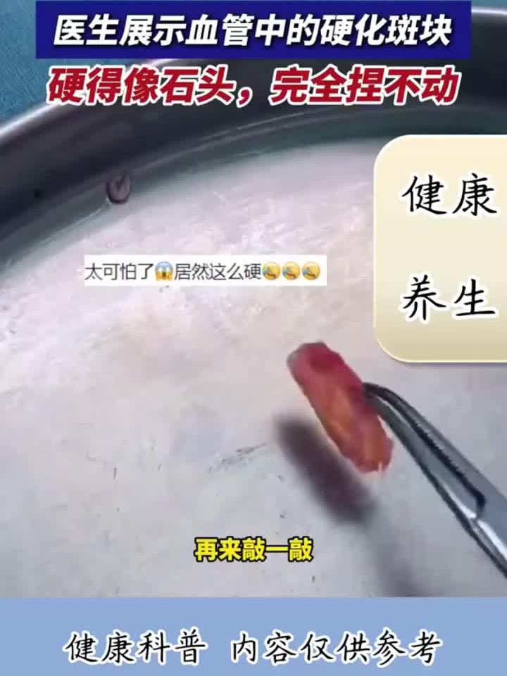 轻食养生新解：油腻饮食如何让血管“水泥化”？