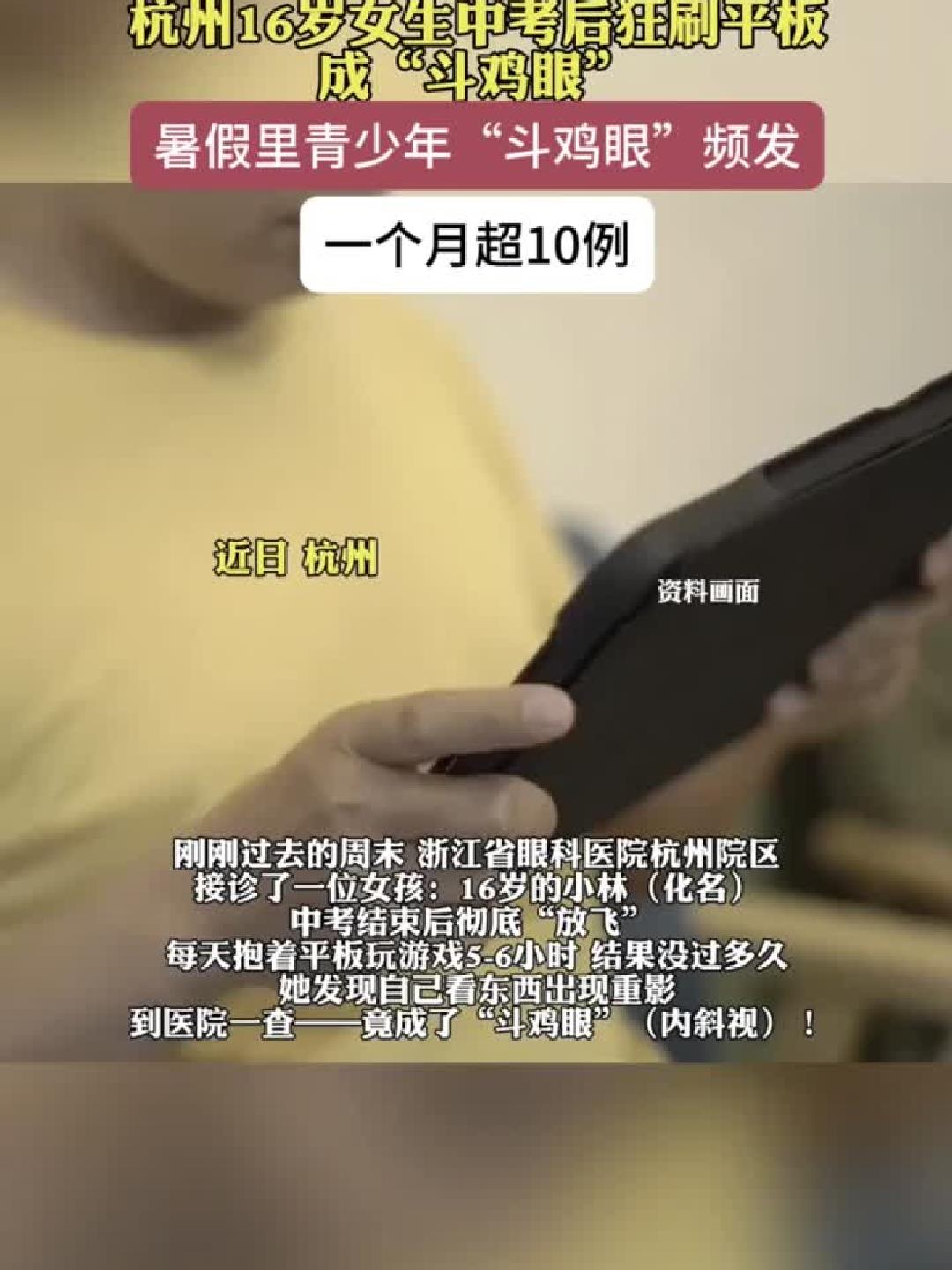 “斗鸡眼”危机!中考后沉迷屏幕,16岁花季少女双眼险“报废”