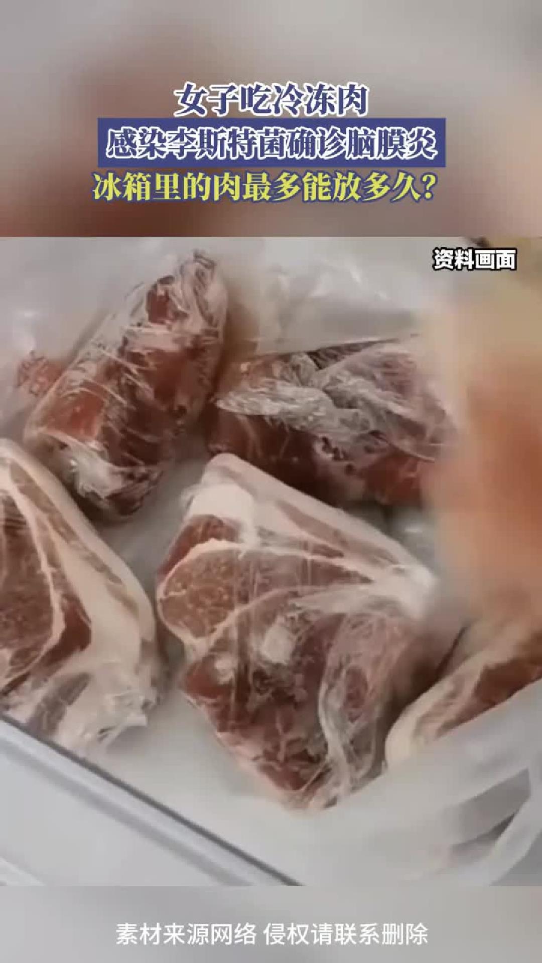 健康知识：女子吃冷冻肉感染李斯特菌确诊脑膜炎，冰箱里的肉最多能放多久？