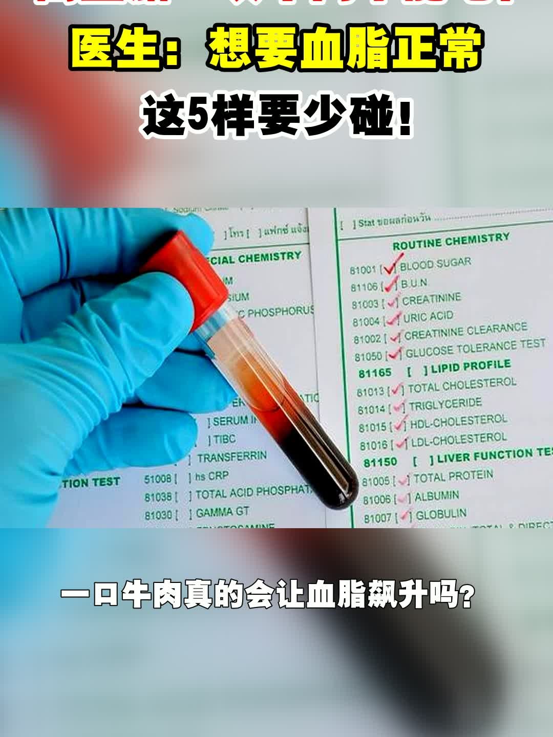 高血脂一块牛肉不能吃?医生:想要血脂正常,这5样要少碰!