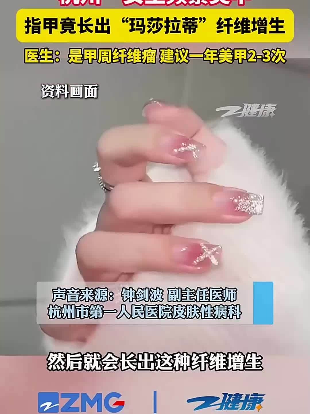 杭州一女生频繁美甲，指甲竟长出“玛莎拉蒂”纤维增生！医生：是