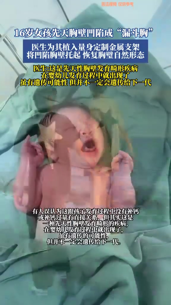 16岁女孩先天胸壁凹陷成“漏斗胸”,医生:这是先天性胸壁发育