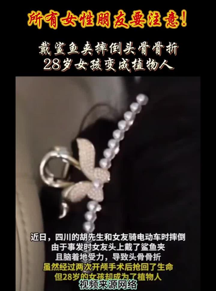 警惕近年来鲨鱼夹伤人事件频发,这个常见的饰品,意外发生时或成隐形凶器