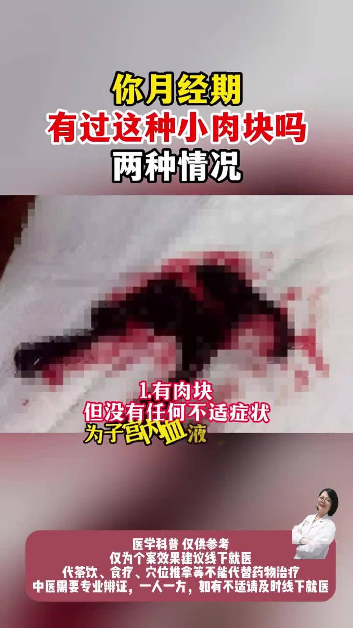你月经期有过这种小肉块吗
