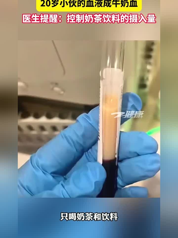 长期不喝水,渴了就喝饮料奶茶。20岁小伙的血液变成牛奶血