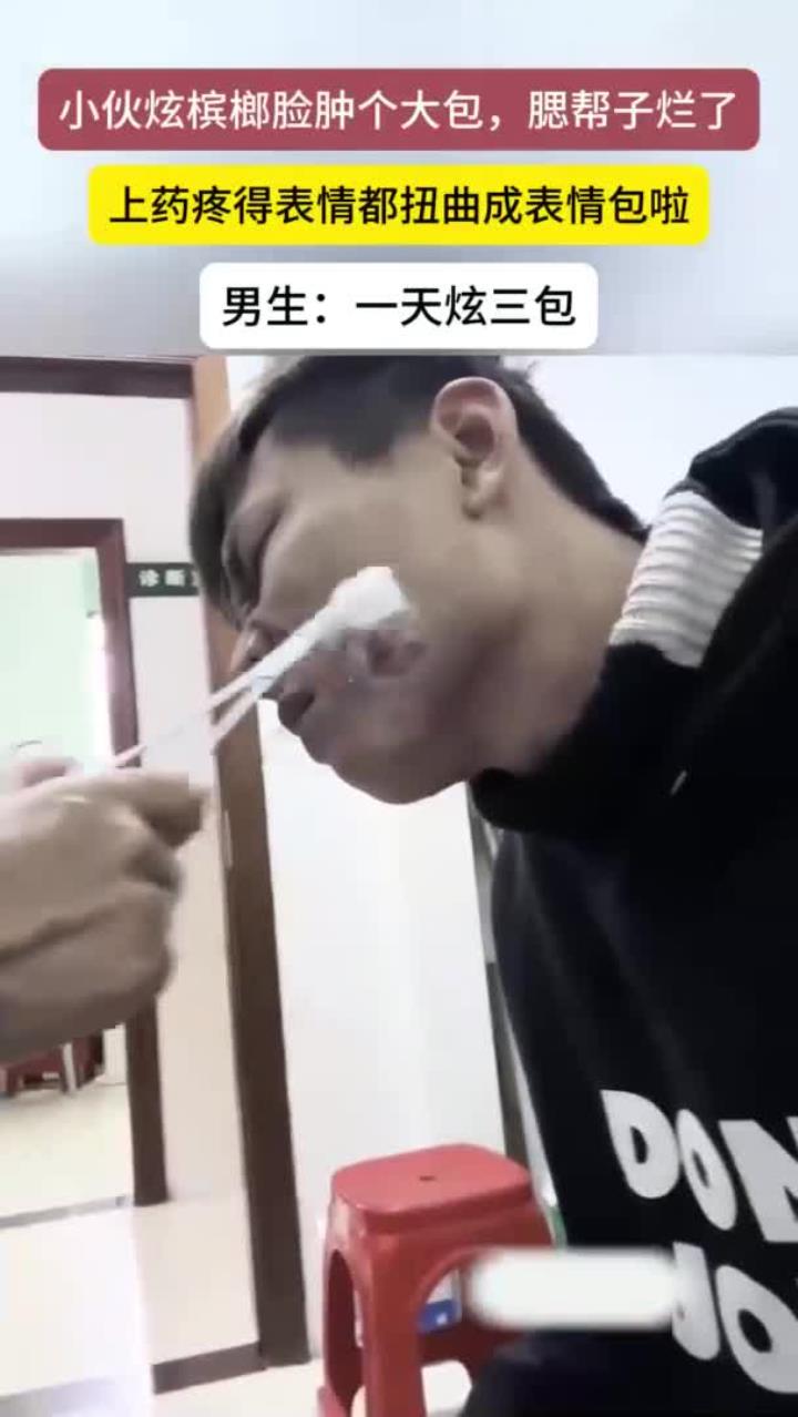 小伙吃槟榔脸上长了一个大包,腮帮子溃烂上药疼出表情包