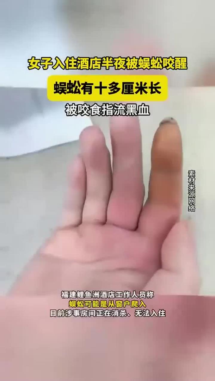 女子入住酒店半夜被蜈蚣咬醒