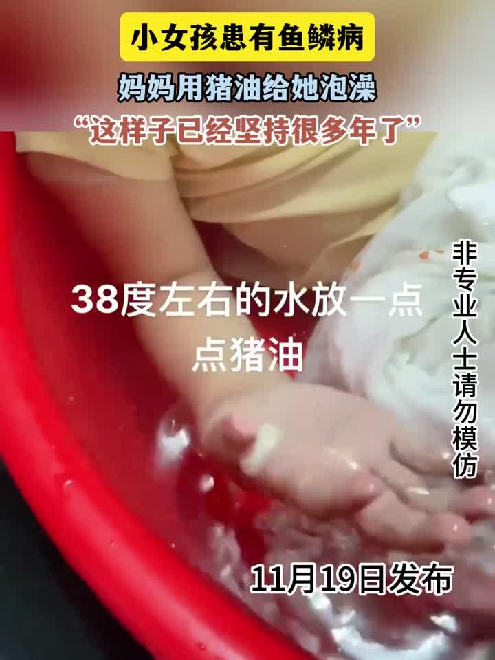 养生简单技巧汇总：小女孩患有鱼鳞病，妈妈用猪油给她泡澡，这