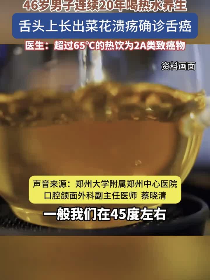男子喝热水养生20年,舌头现菜花状溃烂竟成舌癌