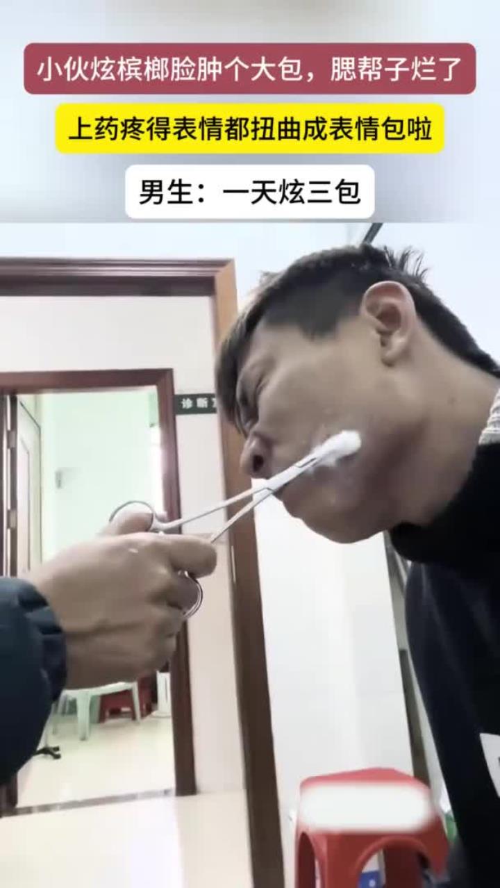 小伙吃槟榔脸上长了一个大包,腮帮子溃烂上药疼出表情包