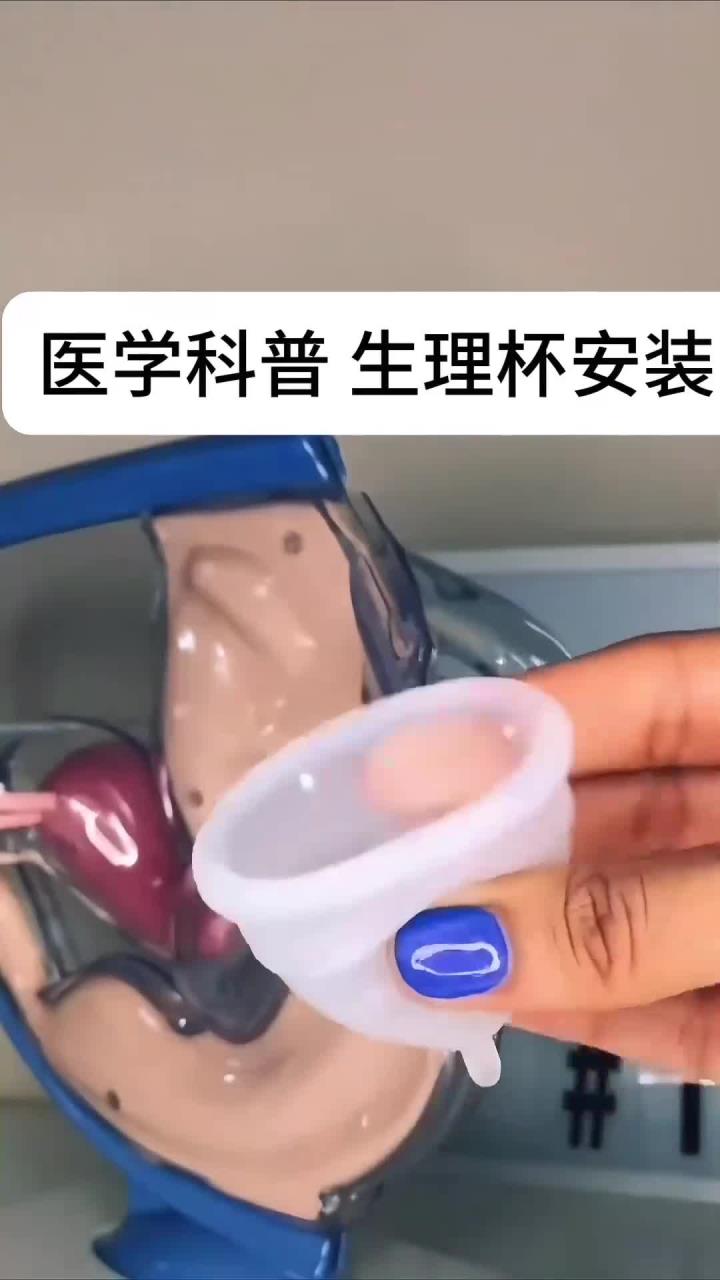 医学生练习:硅胶杯临床操作