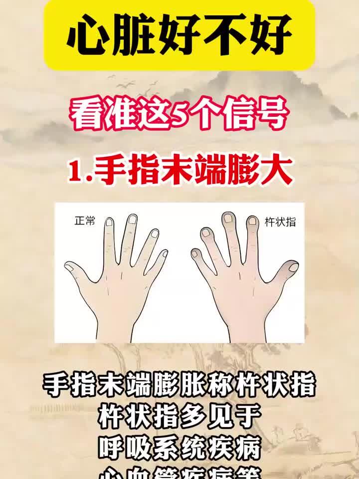 心脏健康预警:这5个迹象不容忽视