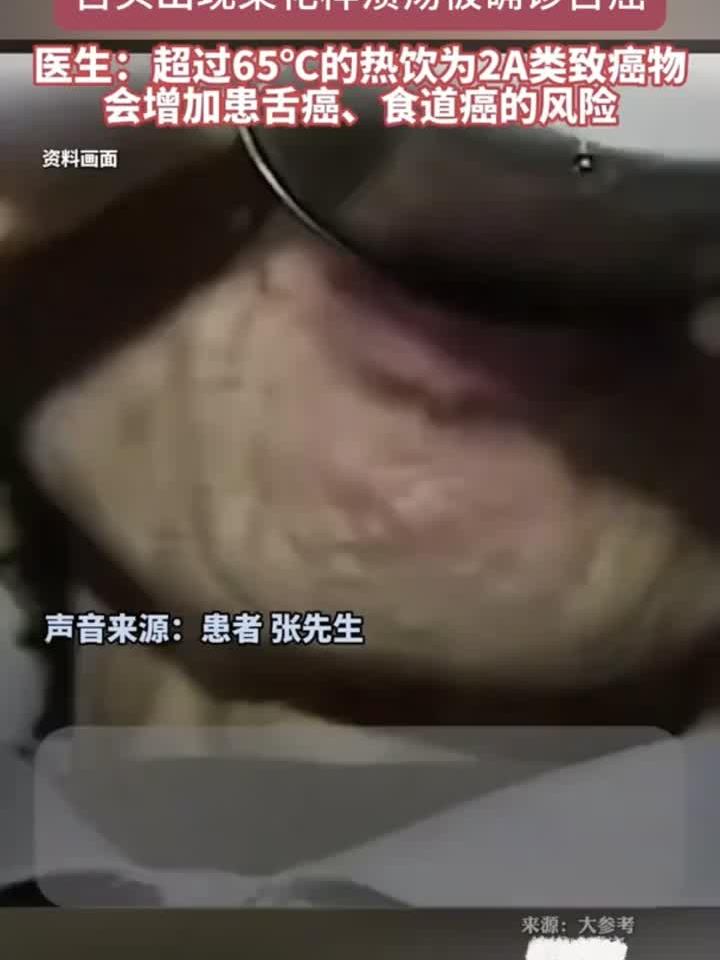 男子喝滚烫热水20年养生,竟致舌面长出菜花样肿瘤确诊癌症