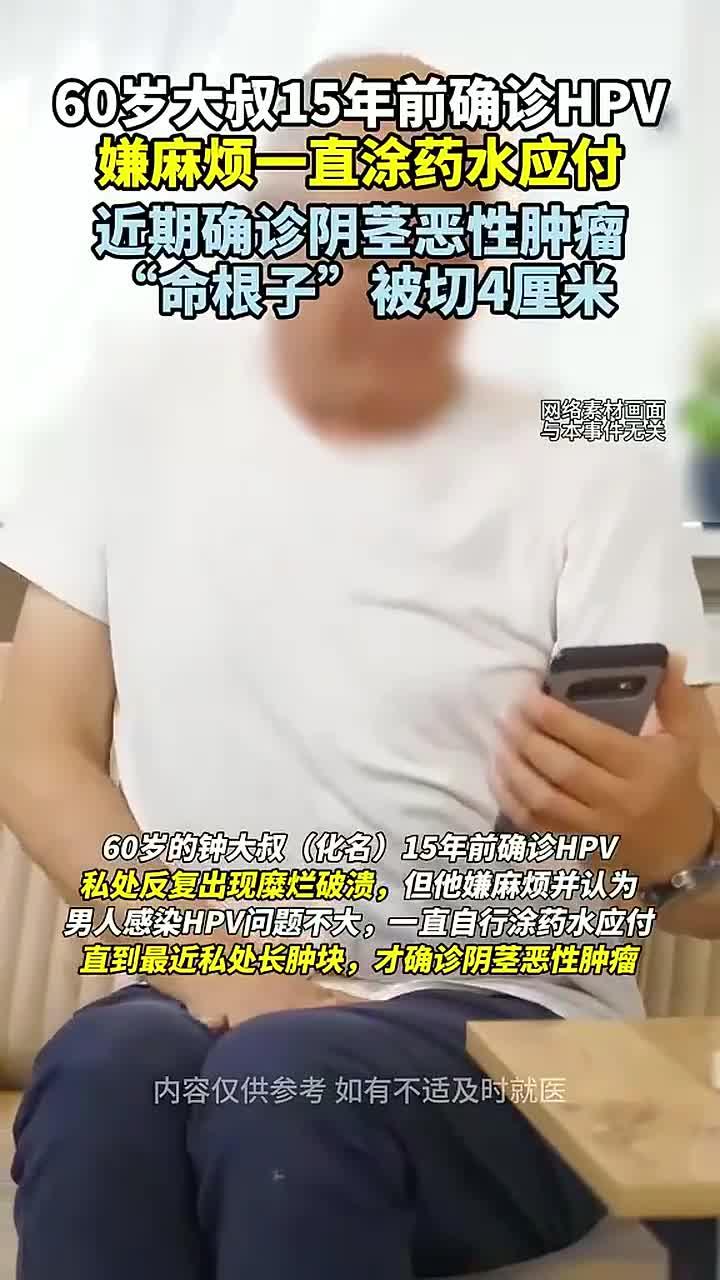 60岁大叔感染hpv耽误15年,阴茎被切掉4厘米。(潇湘晨报)