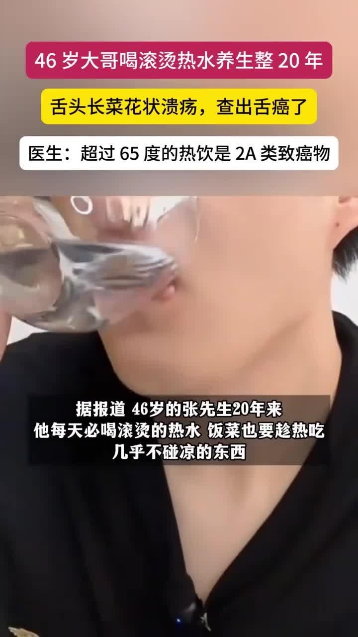 46岁男子20年喝滚烫水养生,竟致舌癌长出菜花样溃疡
