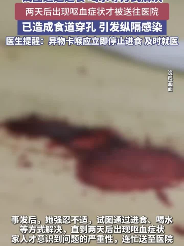 六旬老人吞鸡骨险丧命鸡骨头 卡喉咙怎么办