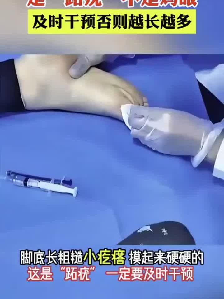 跖疣误认鸡眼？拖延不治或蔓延全身！