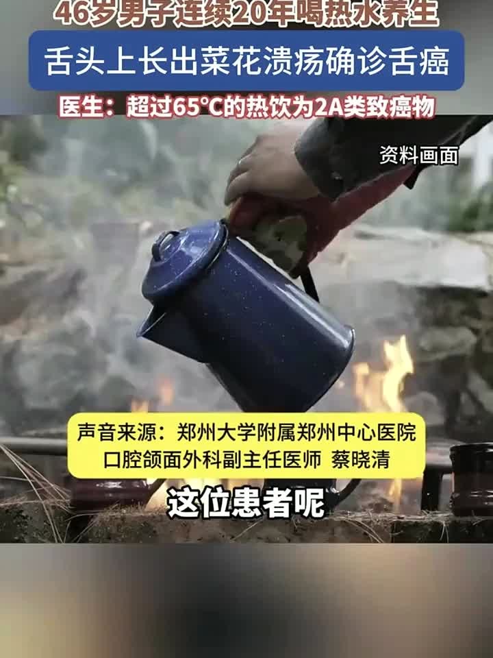 身体科普，46岁男子坚持喝热水20年养生竟患舌癌舌头长出菜花状溃